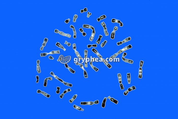 Caryotype non classé 46, XX - gryphea.org